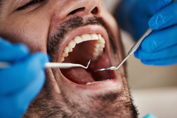 Best Broken or Chipped Tooth Repair in Clear Lake, WI